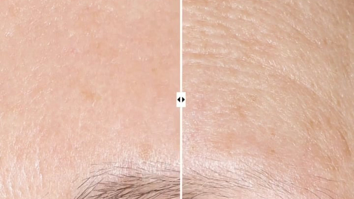 AplhaRet Overnight Cream